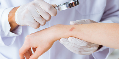 Doctor checking someone's skin using a magnifying glass.